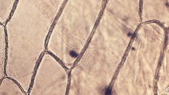 Biology onions cells