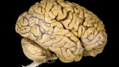 Brain