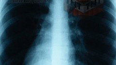 Chest TnT minecraft creeper Xray elenorfist