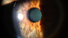 Eyes can high some get Resolution irisdownload