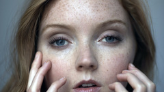 Freckles