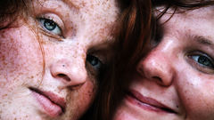 Freckles gingerkids