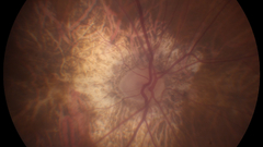 Gilbert what about high