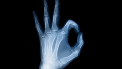 Hands X-ray