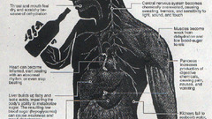 Hangover info anatomy