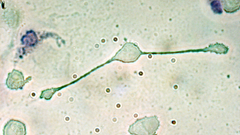 Macrophage pmore The artist