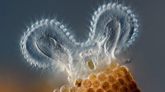 Microscopic microscopic photography