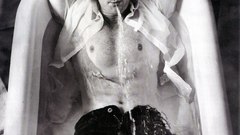 Neil patrick harris open