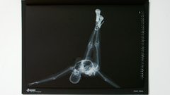 Pinups X-ray nude