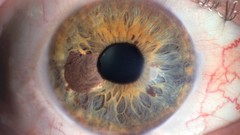 Saying high same Resolution blip