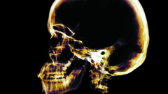 Skeleton skull high Xray
