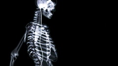 Skeletons black background