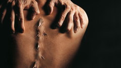 Spine Photo manipulation