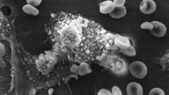 The high macs killing