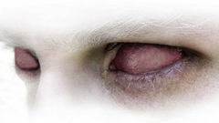 White red eyes albino