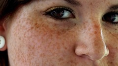 Woman freckles faces