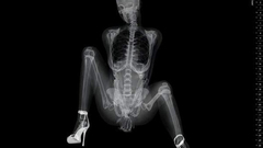 Woman X-ray upscaled