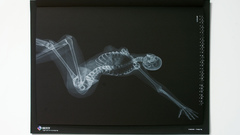 X-ray nude