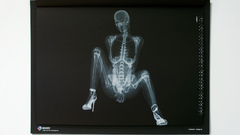 X-ray nude
