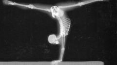 X-ray x-ray potograpy