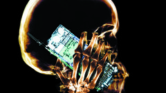 Xray body skeleton high