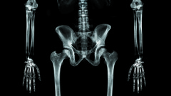 Xray body skeleton high