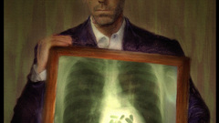 Xray vicodin Hugh Laurie