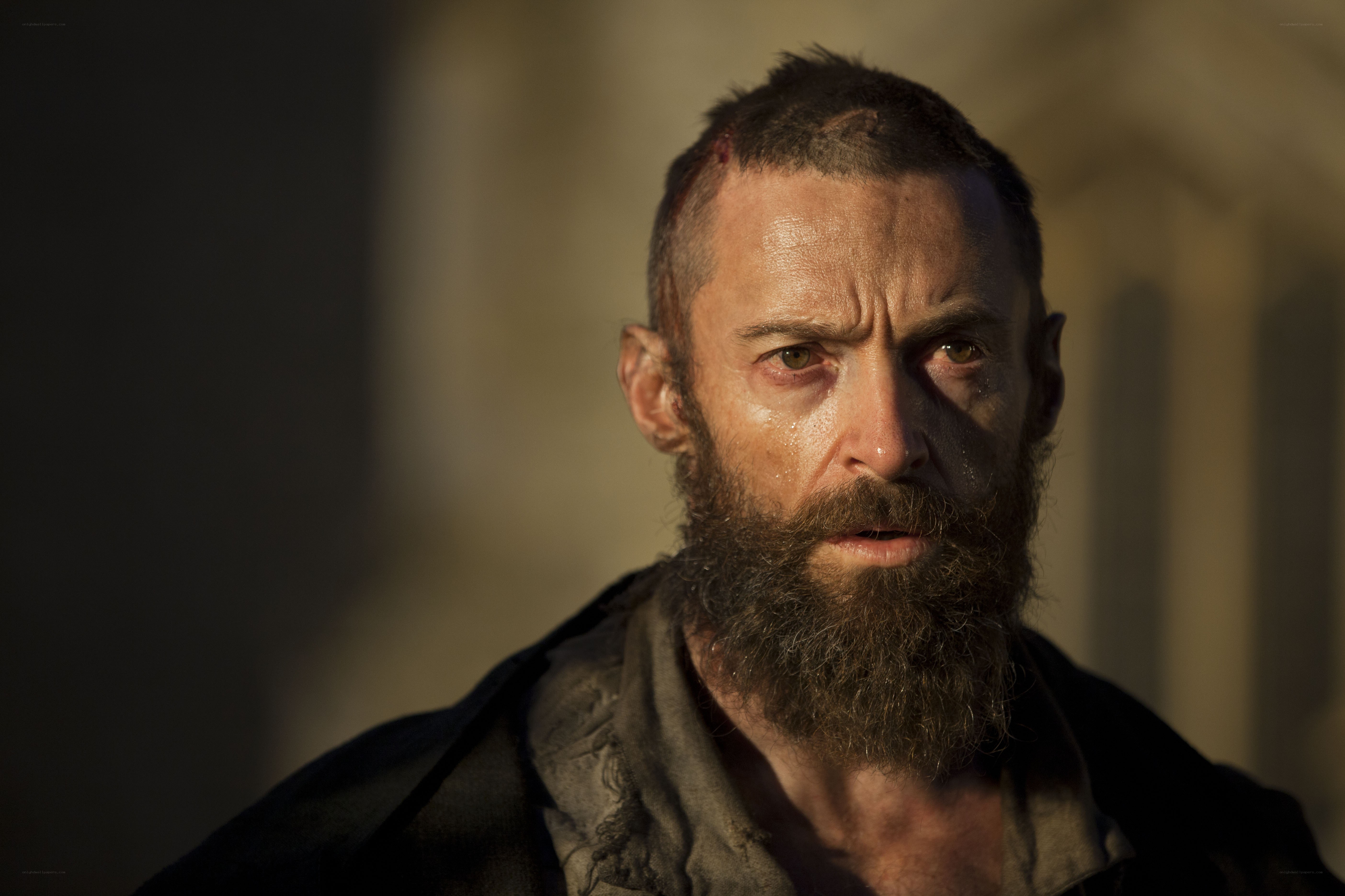 man with beard and injury
