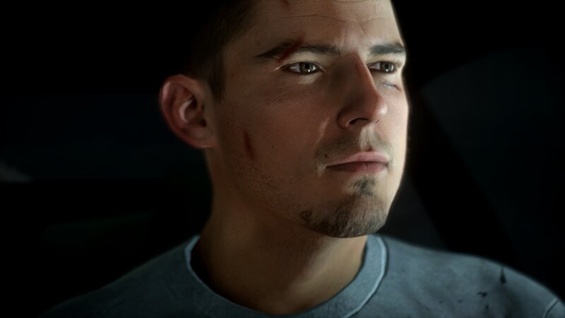 Man with Facial Injuries — Black