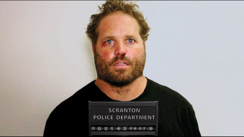man with facial injuries in mugshot