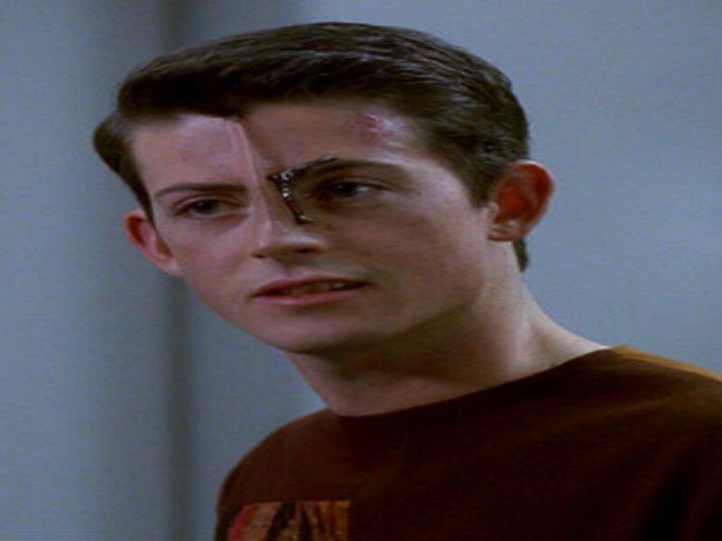Man with Facial Injury — Brown, Serious