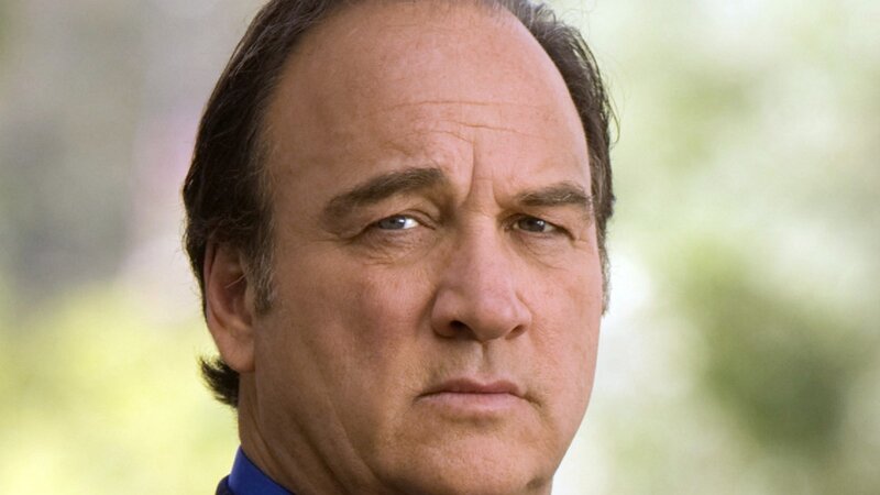 Man with Receding Hairline