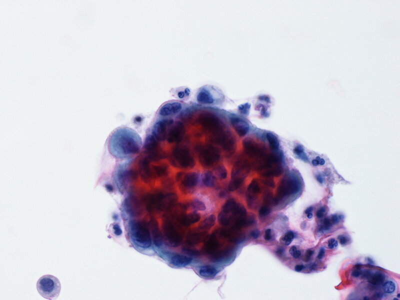 microscopic cell cluster