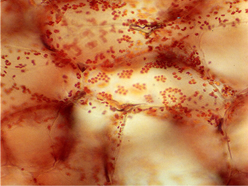 Microscopic Cells — Red