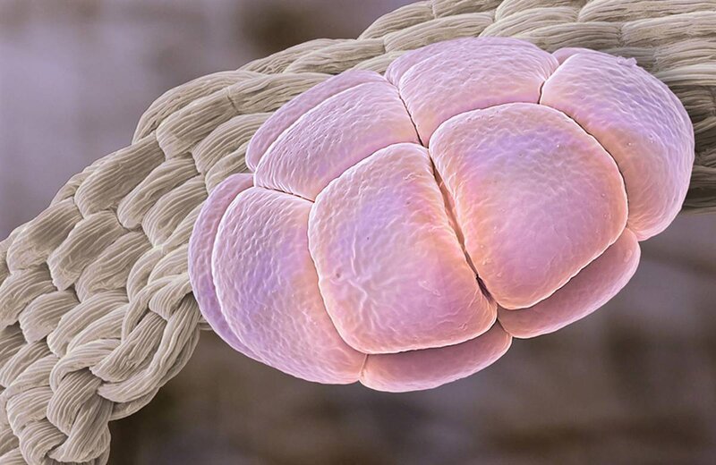 Microscopic Hair Strand