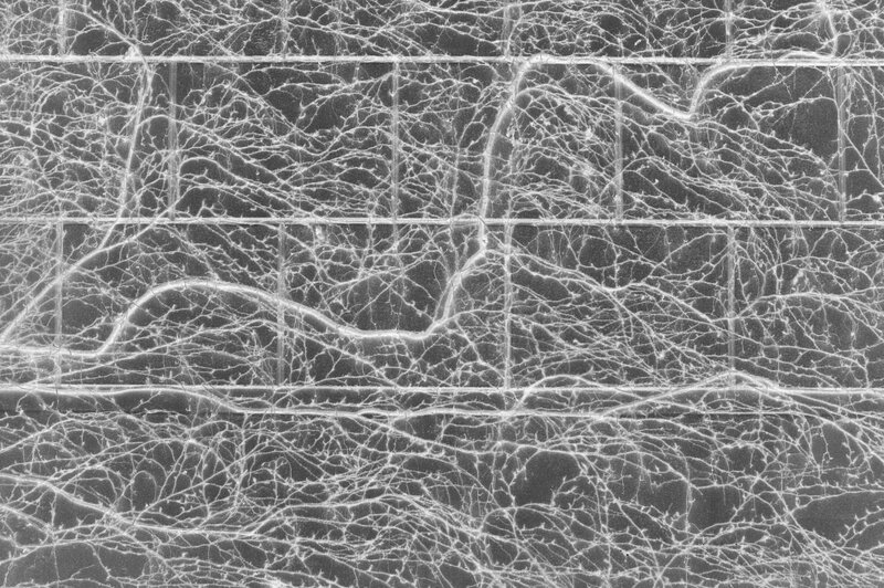 microscopic network pattern