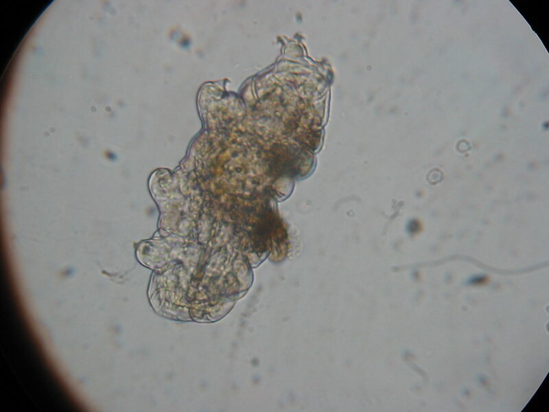 microscopic organism under lens