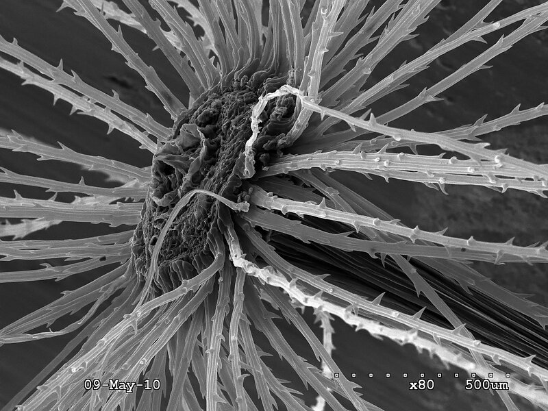 microscopic sea urchin spines
