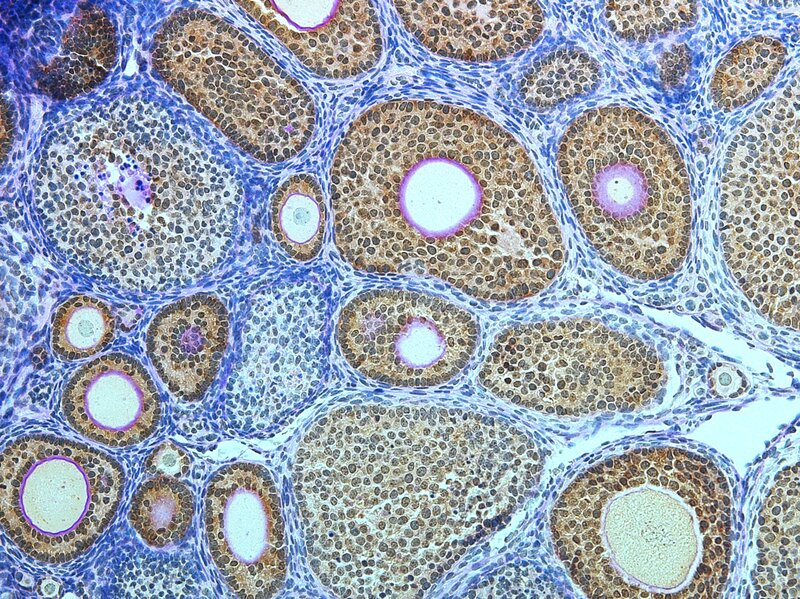 Microscopic tissue section