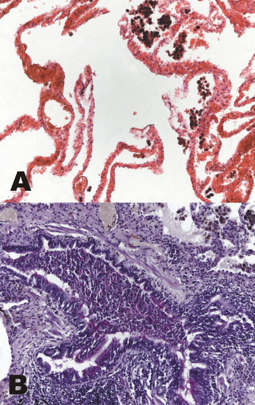 Microscopic tissue sections
