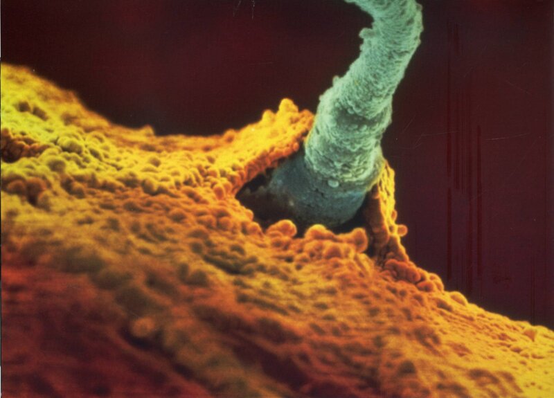 Microscopic view of a fungal hypha
