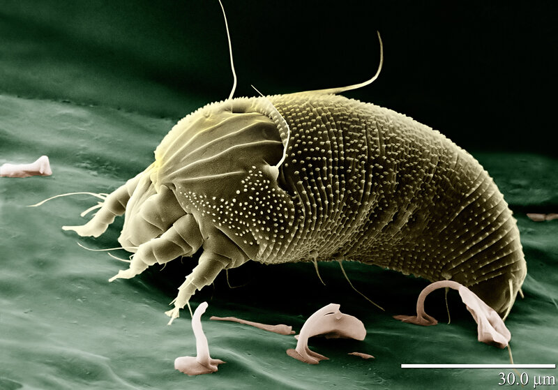 Microscopic view of a springtail