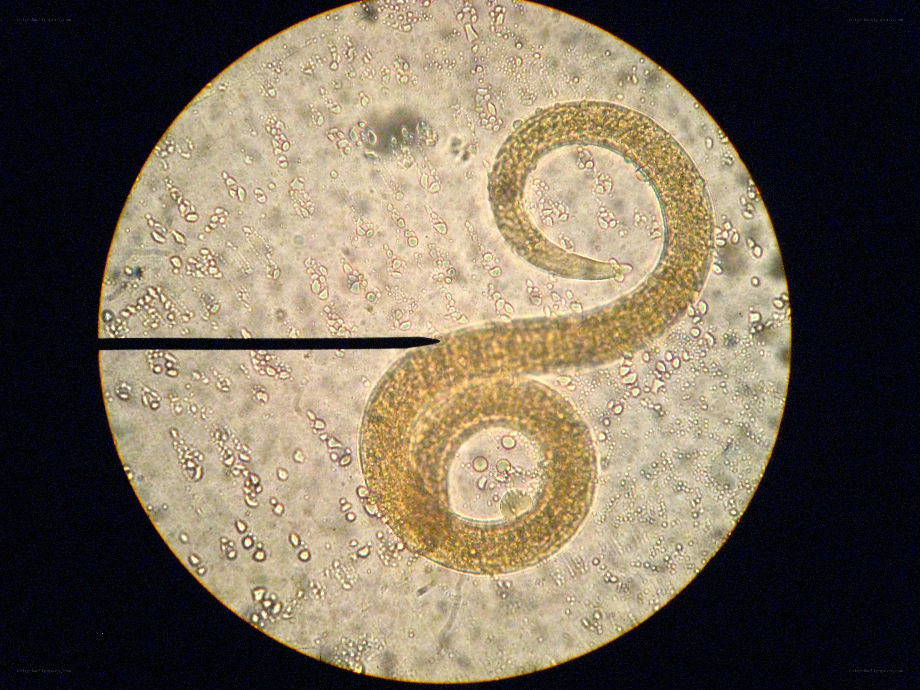 microscopic view of a worm