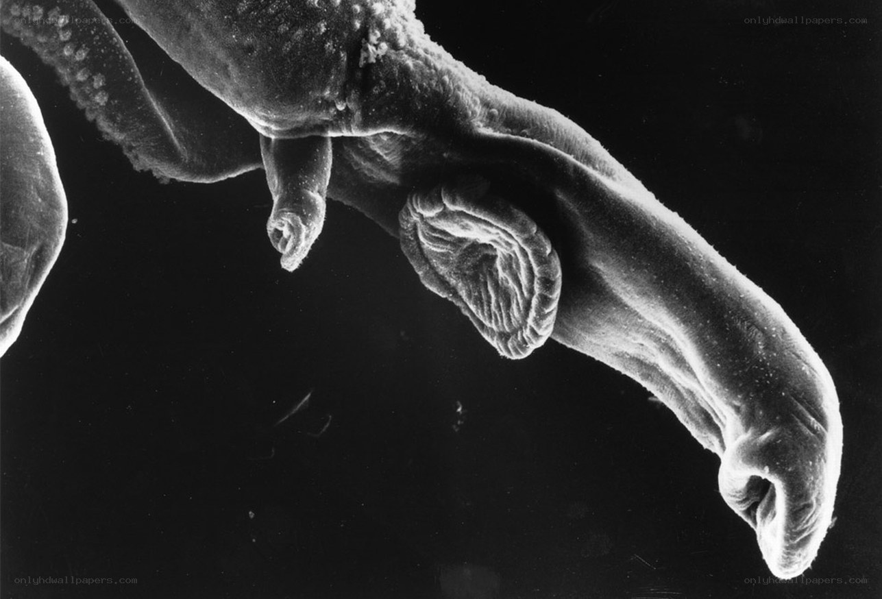 Microscopic view of a worm