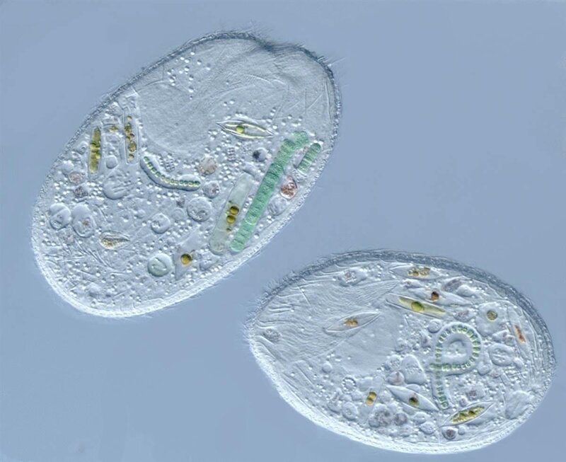 Microscopic view of ciliates