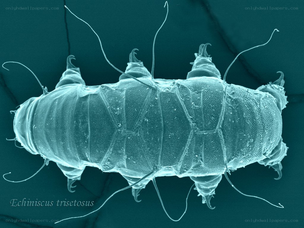 Microscopic view of Echiniscus trisetosus