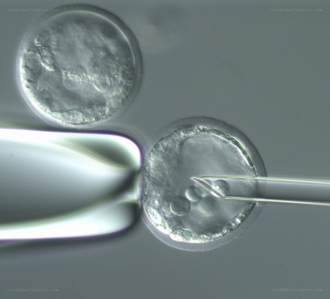 Microscopic view of embryo manipulation