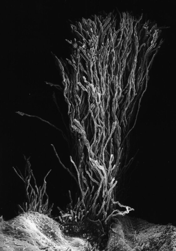 microscopic view of fungal hyphae