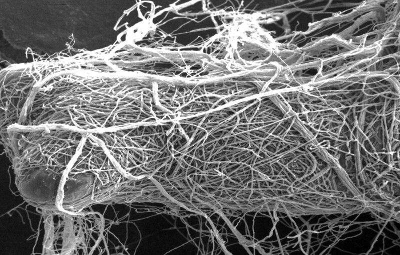 microscopic view of fungal hyphae