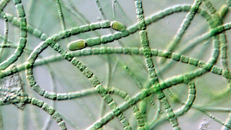 microscopic view of green algae